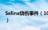 Selina烧伤事件（1022上海Selina烧伤事故）