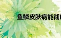 鱼鳞皮肤病能彻底治愈吗（鱼鳞）