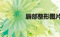 唇部整形图片（唇部整形）