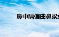 鼻中隔偏曲鼻梁歪斜（鼻梁歪斜）